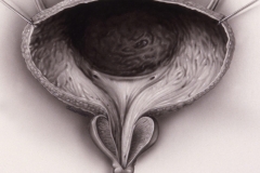 Bladder, Prostate - Medical 	Journal