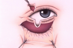 Medical Journal - Head and Neck