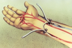 Hand_12x16_Sept_1986_Web