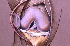 Knee Surgery - Medical Journal